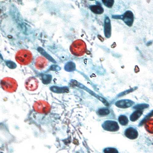 Pool Water Pathogens